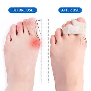 Corrector de <span class=keywords><strong>Dedos</strong></span> del Pie, Corrector de <span class=keywords><strong>Martillo</strong></span>, Vendaje Separador de <span class=keywords><strong>Dedos</strong></span>, Férula con Gel de Silicona, Corrector de <span class=keywords><strong>Dedos</strong></span> del Pie - Product Image 3