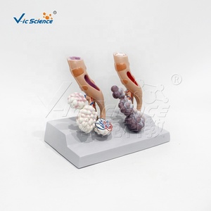 Modelo <span class=keywords><strong>de</strong></span> Comparación <span class=keywords><strong>de</strong></span> Pulmones: Pulmón Saludable vs. Pulmón <span class=keywords><strong>de</strong></span> <span class=keywords><strong>Fumador</strong></span> con Base, Herramienta Educativa para el Control del Tabaco - Product Image 2