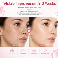 Sérum Éclaircissant Anti-Taches à la Niacinamide et à l'Acide Tranexamique pour le Visage – Anti-Âge, Blanchissant, Peau de Verre, Teint Radieux et Clarifiant