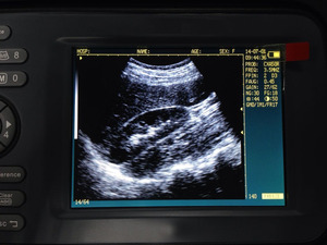 2024 termurah genggam portabel dokter hewan pemindai Ultrasound <span class=keywords><strong>probe</strong></span> Mini mesin Ultrasound untuk reproduksi - Product Image 2