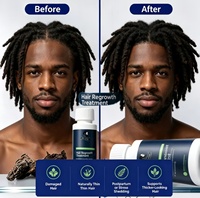 Sérum de croissance capillaire, bloqueur de DHT, traitement anti-chute de cheveux, concentration personnalisée, emballage d'usine OEM