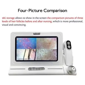 High Resolution Laser Beauty Equipment Scalp Analyzer with Camera for Comprehensive Hair & Scalp Health Assessment - Product Image 3