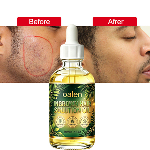 Huile Douce Luxfume à Marque Blanche Infusée au Bisabolol pour Poils Incarnés – Réduit les Rougeurs et les Boutons de Rasoir, Restaure la Barrière Cutanée, Corps Entier - Product Image 1
