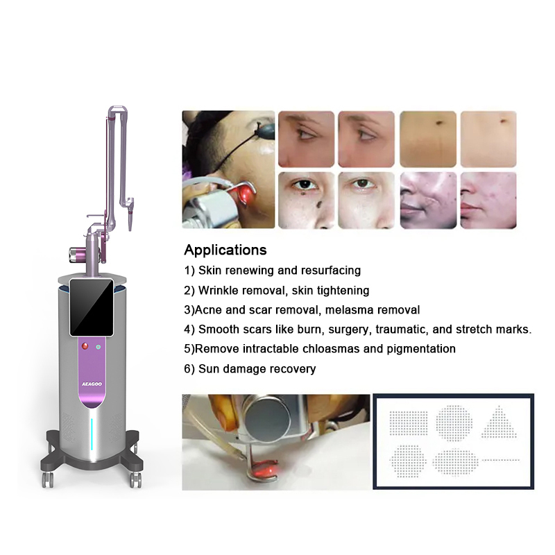 Powerful Tattoo Scar mole freckle Removal