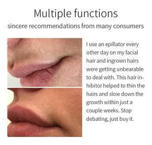 Crema <span class=keywords><strong>de</strong></span> eliminación <span class=keywords><strong>de</strong></span> <span class=keywords><strong>vello</strong></span> púbico para hombres y mujeres, crema <span class=keywords><strong>de</strong></span> Aloe Vera para axila facial y corporal, eliminador <span class=keywords><strong>de</strong></span> <span class=keywords><strong>vello</strong></span> permanente indoloro <span class=keywords><strong>de</strong></span> etiqueta privada - Product Image 3