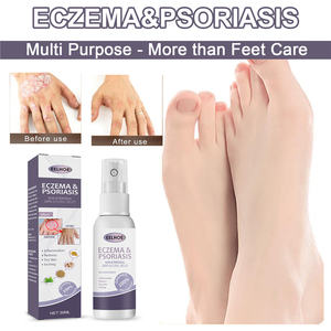 EELHOE 30ml eczema psoriasis spray <span class=keywords><strong>piel</strong></span> Inflamación enrojecimiento picazón psoriasis eczema dermatitis <span class=keywords><strong>tratamiento</strong></span> líquido - Product Image 2