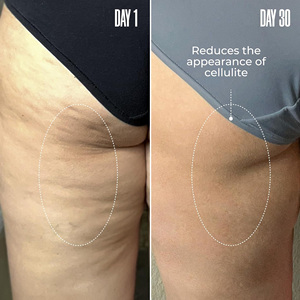 OEM Lift Firm Booty Mask Leave-On Celulitis Mask Reduce la celulitis Visiblemente Apriete Booty Muslos Brazilian Peppertree Mask - Product Image 4