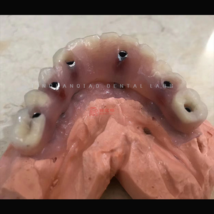 ทันตกรรมรากฟันเทียมทางคลินิกที่มีครอบฟันเซอร์โคเนียและกรอบไทเทเนียมครอบฟันพอร์ซเลนโคบอลต์และโครเมี่ยม - Product Image 4