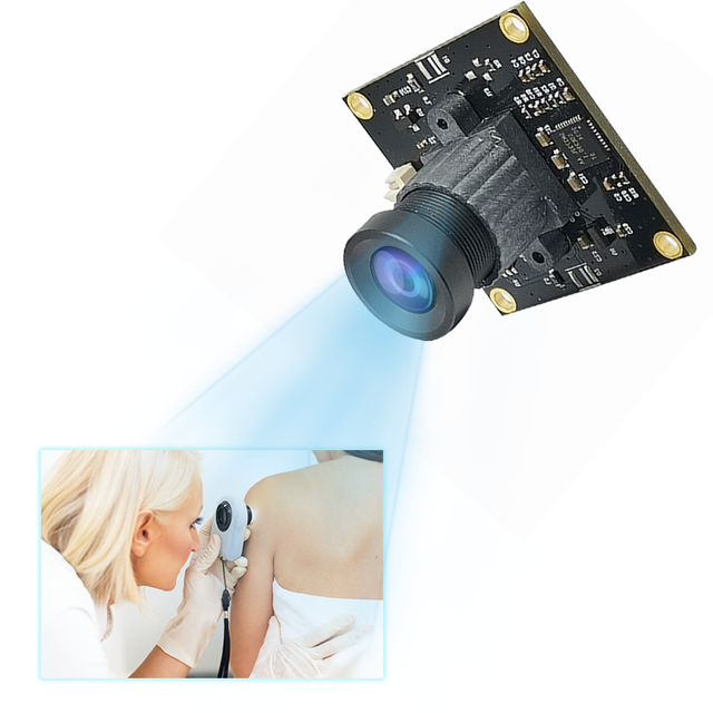 Wide Angle CMOS Sensor 5MP USB OV5640 Camera Module Skin Detection HFOV135 Image Sensor