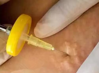 Mesin Carboxytherapy C2P Bertenaga Kartrid Gas CO2 Baja Kelas Medis 12g, Peralatan Kecantikan Pengencangan Wajah Berbasis Silinder Gas