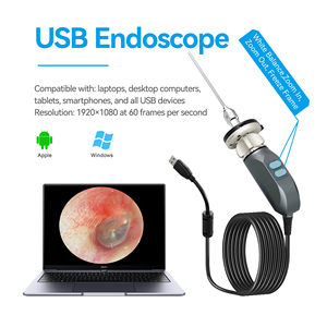 Medical Endoscope USB2.0/USB3.0 4K Camera with HDMI/SDI Output - Product Image 3