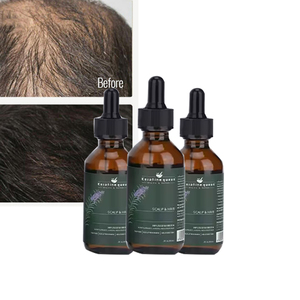 Aceite de crecimiento orgánico natural <span class=keywords><strong>para</strong></span> tratamiento <span class=keywords><strong>del</strong></span> <span class=keywords><strong>cabello</strong></span>, mezcla de hierbas, aceite de argán y Romero <span class=keywords><strong>para</strong></span> <span class=keywords><strong>el</strong></span> crecimiento <span class=keywords><strong>del</strong></span> <span class=keywords><strong>cabello</strong></span>, <span class=keywords><strong>beneficios</strong></span> anticaspa - Product Image 1