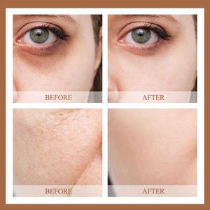 เซรั่มบำรุงผิวเซรั่มต่อต้านริ้วรอยเซรั่มคาเฟอีนบำรุงผิวใบหน้าให้ผิวขาว - Product Image 5