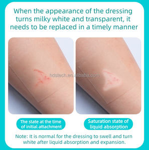 <span class=keywords><strong>Pansement</strong></span> adhésif médical hydrocolloïde en rouleau, découpable sur mesure, et patch anti-boutons pour les ampoules, l'acné et les cicatrices |   Transparent et imperméable - Product Image 6