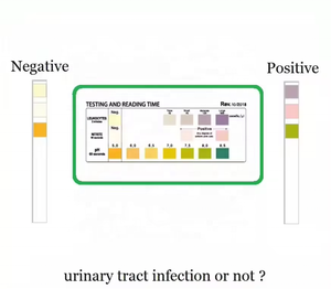 Bandelettes de test <span class=keywords><strong>urinaire</strong></span> pour l'analyse <span class=keywords><strong>urinaire</strong></span>, tests de nitrites/proteines/pH pour la détection des infections des voies urinaires, examen de l'acuité visuelle, appareil CE - Product Image 5