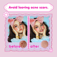 Patch anti-acné en diamant coloré imperméable, épaisseur personnalisée, patch anti-boutons en diamant, marque privée pour les soins de la peau