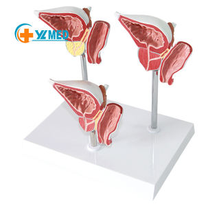 Modelo Anatómico <span class=keywords><strong>de</strong></span> Patología <span class=keywords><strong>de</strong></span> la Próstata 3 en 1, Muestra BPH Normal y Cáncer con Vejiga y Recto, para Entrenamiento Médico y Educación del Paciente - Product Image 1