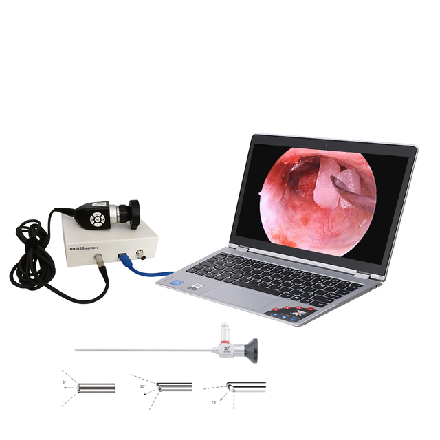 Medical 1100 Lines Usb Ent Endoscopy Camera System with Portable Endoscope LED Light Source