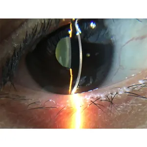 S150D China ophthalmic 6X Tragbare tier ärztliche menschliche Spaltlampe