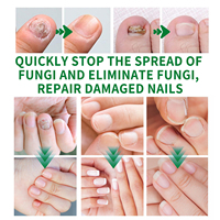 Sérum Traitant Efficace et Puissant pour les Mycoses des Ongles en 7 Jours – Solution Réparatrice et Nourrissante pour Ongles Abîmés – Huile Naturelle à Base de Plantes pour les Ongles