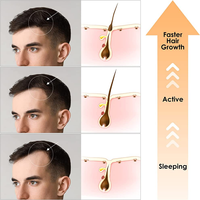 Huile de romarin naturelle de marque privée Sérum bio pour la croissance des cheveux contre la chute des cheveux Huile de romarin Produits pour la croissance des cheveux