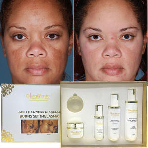 Набор для удаления покраснений и ожогов на лице - Product Image 3