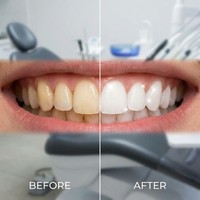 Fabricant de dentifrice jetable personnalisé pour adultes – Blanchissant, menthe fraîche, contrôle du tartre, dents sensibles, anti-caries, usage domestique, faible coût