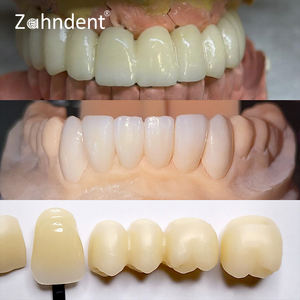 Zahndent matériaux dentaires à haute translucidité 46% rentable disque de zircone bloc de zircone multicouche SHT - Product Image 4