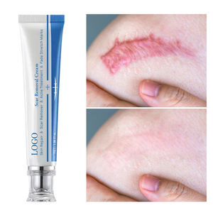 Vente en gros de 30ml de sérum gel contre l'acné crème de cicatrice efficace pour réparer les brûlures de <span class=keywords><strong>grossesse</strong></span> crème de traitement chirurgical des brûlures lotion pour le <span class=keywords><strong>visage</strong></span> - Product Image 3