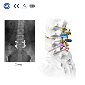 Instrumental Quirúrgico de Grado Médico, Set de Endoscopia Espinal para Cirugía de Columna UBE, Ortopedia Mínimamente Invasiva, CE - Product Image 5