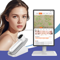 Ultimo Dispositivo di Bellezza AI Digitale 2 in 1 con Analizzatore di Pelle e Cuoio Capelluto a Tripla Immagine Spettrale, Fotocamera da 8MP con Ingrandimento 50x per la Perdita dei Capelli