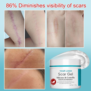 Gel Cicatrisant OEM ODM au Silicone et Centella Asiatica pour Réduire les Rougeurs, les Démangeaisons, Apaiser et Adoucir les Chéloïdes, Vergetures et Cicatrices de Brûlures - Product Image 5