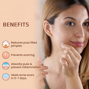 Patchs Hydrocolloïdes en Gros pour Boutons avec Huile d'Arbre à Thé et Acide Salicylique – Traitement Invisible et Léger de l'Acné – Soin de Nuit - Product Image 3