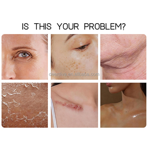 Crema Corporal Iluminadora con Vitamina C y Cúrcuma Recomendada por Dermatólogos de 500 ml, Reduce las Arrugas y Mejora la Elasticidad - Product Image 5