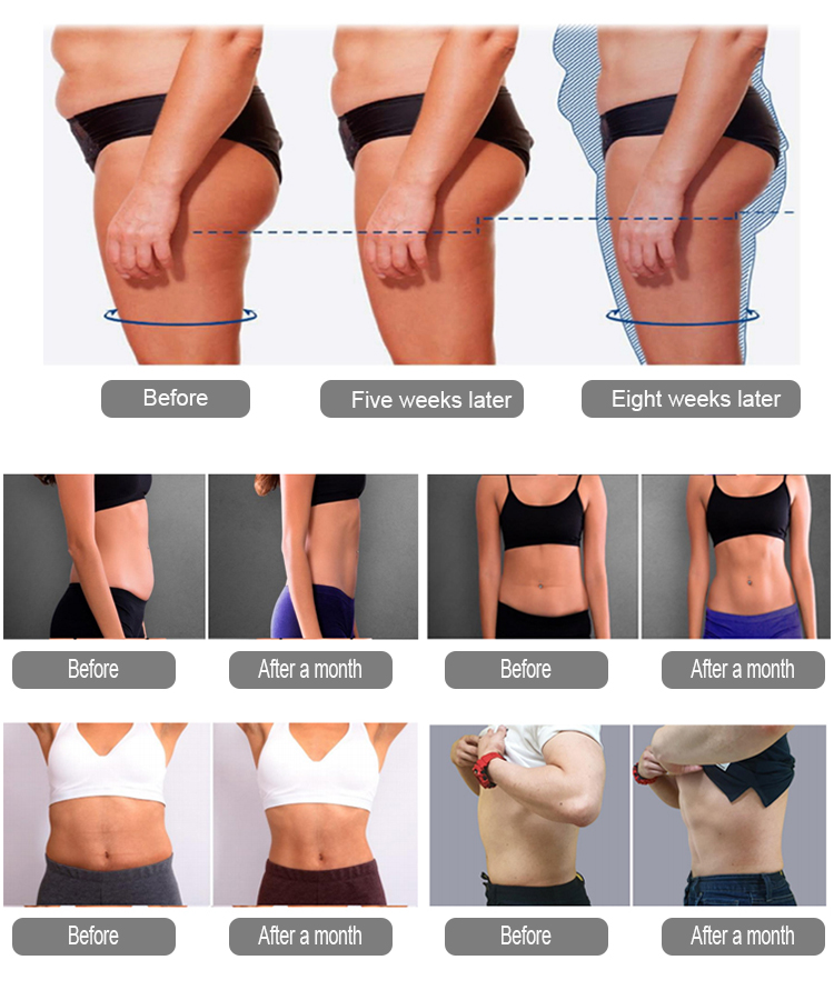 Body Contouring Sculpting Ems Slimming Machine Vertical 4 Handles