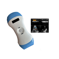 Escáner de Ultrasonido Doppler Color Inalámbrico 3 en 1, Equipo Hospitalario con Sonda Inalámbrica para Mascotas