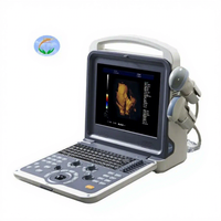 Système de diagnostic par ultrasons Doppler couleur 4D à prix compétitif 6 langues ultrasons portables