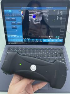 Dokter Hewan pencitraan otot ultrasound 3 in 1 probe nirkabel WIFI warna <span class=keywords><strong>doppler</strong></span> ultrasound - Product Image 4