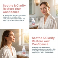 Lotion séchante à l'acide salicylique pour peaux sujettes à l'acné avec niacinamide et glycérine pour une exfoliation et une hydratation douces, logo personnalisé