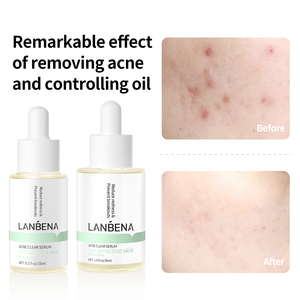 Suero Facial Revox Instant Lift OEM para Piel Grasa, Sueros para Máquina Hidrofacial, Ácido Poliglutámico, Suero Blanqueador con Ácido Salicílico - Product Image 6