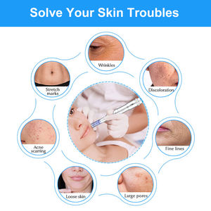 Agujas de Repuesto Comqytech para Microblading, Desechables, 12/36/42 Pines, Modelo KQ488, <span class=keywords><strong>Dermapen</strong></span>, Tatuaje de Cejas, Maquillaje Permanente - Product Image 6