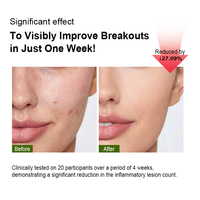 Crème Visage Apaisante et Éclaircissante à la Houttuynia Cordata, Niacinamide et Acide Hyaluronique – Hydratation et Équilibre de la Sécrétion de Sébum – Meilleure Vente