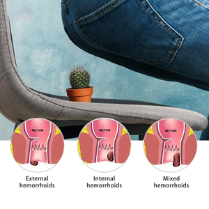 Crème aux herbes naturelles pour les hémorroïdes, fissures anales internes et externes, douleur, pommade pour hémorroïdes 25g - Product Image 2