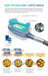 เครื่องสลายไขมันแบบไม่รุกล้ำ Cryo 360 พร้อมแผ่น Lipo สำหรับยกกระชับใบหน้าและปรับรูปร่าง - Product Image 3