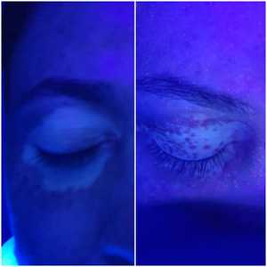 Analizador de Piel, Lámpara de Wood para Análisis Facial, Detector de Bacterias y Hongos, Luz Ultravioleta para Detectar Psoriasis, Vitíligo y Eccema - Product Image 3