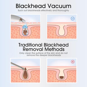 Aspirador <span class=keywords><strong>facial</strong></span> eléctrico portátil, aparato de belleza <span class=keywords><strong>para</strong></span> el hogar <span class=keywords><strong>para</strong></span> el cuerpo, espinillas faciales y removedor de poros, cuidado del acné - Product Image 6