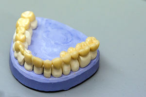 Blocchi di <span class=keywords><strong>Zirconia</strong></span> Yucera, Blocchi di <span class=keywords><strong>Zirconia</strong></span> per Sinterizzazione ST Approvati CE Crogiolo di <span class=keywords><strong>Zirconia</strong></span> Dentale - Product Image 6