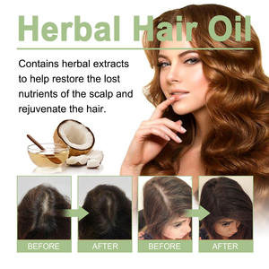 Aceite orgánico a base de hierbas para el cabello para la caspa y la pérdida de cabello, suero para el tratamiento del cuero cabelludo anticaída para un crecimiento rápido y esencia fortalecedora - Product Image 3