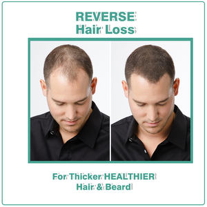 Meilleures ventes Extrait de baies de palmier nain biologique Supplément pour soutien de la prostate pour hommes actifs Capsules de palmier scie - Product Image 4