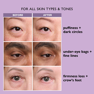 Mắt tạm thời làm săn chắc huyết thanh thắt chặt dưới mắt Kem giảm nếp nhăn chăm sóc mắt Mặt Peptide Kem mắt cho túi mắt - Product Image 6